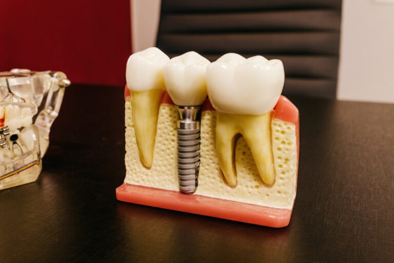 Gum disease can lead to major health issues if left untreated.