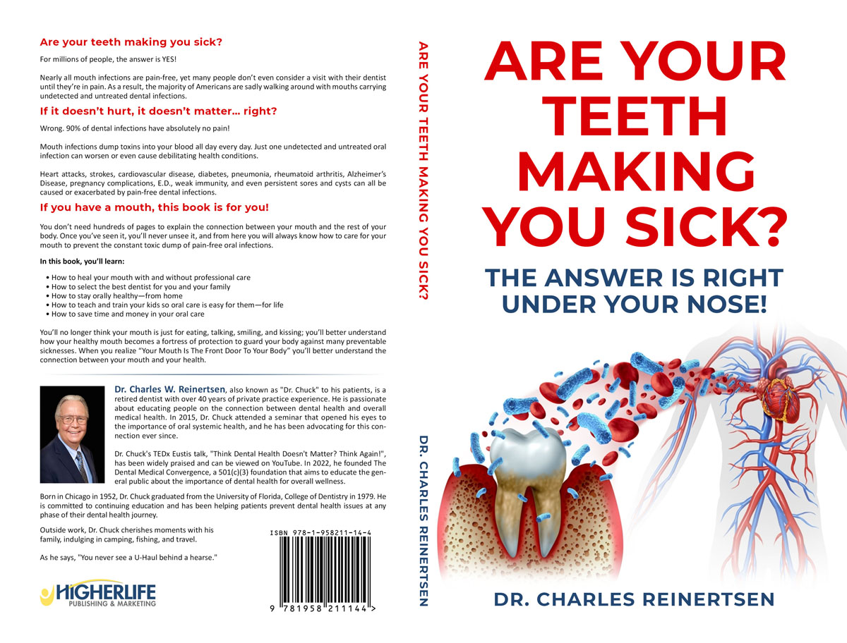 are your teeth paperback style