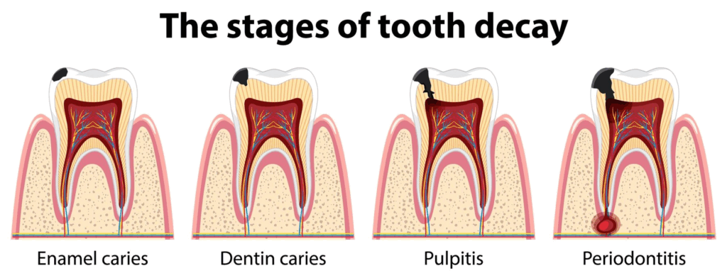 The Hidden Dangers of Gum Disease: What Every Family Should Know