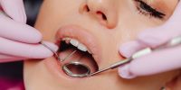 look inside the mouth for health issues