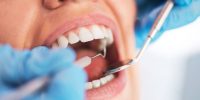 oral-health-melchers